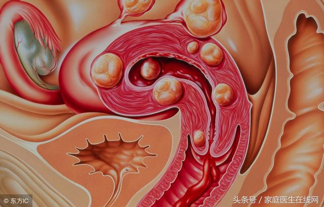 spiritual-root-of-uterine-fibroids