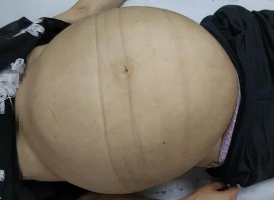 33 Livres Je Pensais Que C Etait Gros Sur Mon Ventre Mais J Ai Cache Une Grosse Bombe Daynewsfr