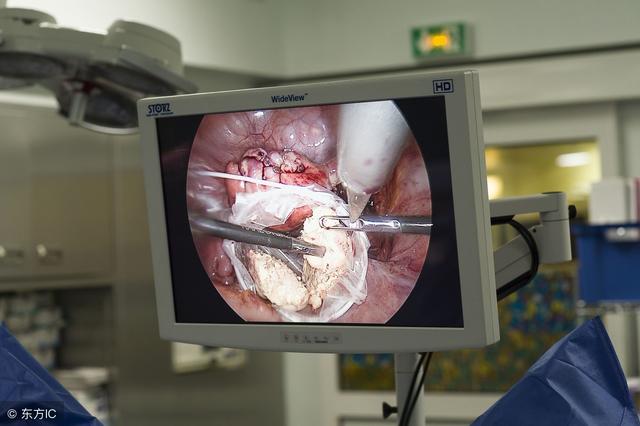 巧克力囊肿直径达到3厘米时需要进行手术治疗