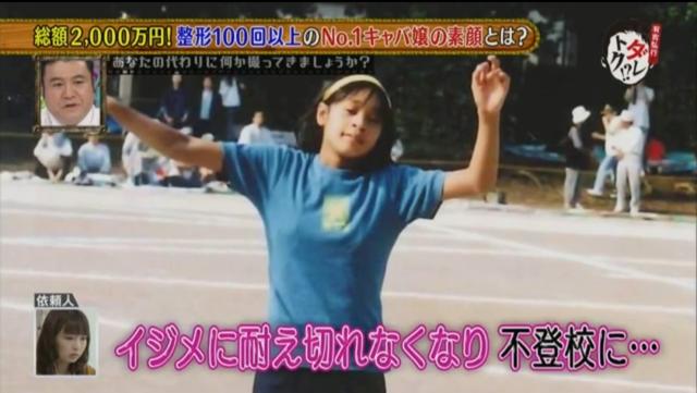 因长相酷似大猩猩花两千万整容，如今她成为日本第一女公关…