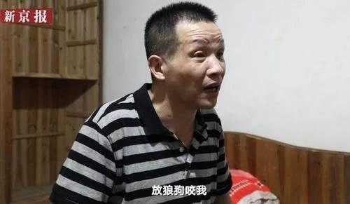 张玉环自曝6天6夜刑讯逼供 手臂有被狼狗咬的伤痕