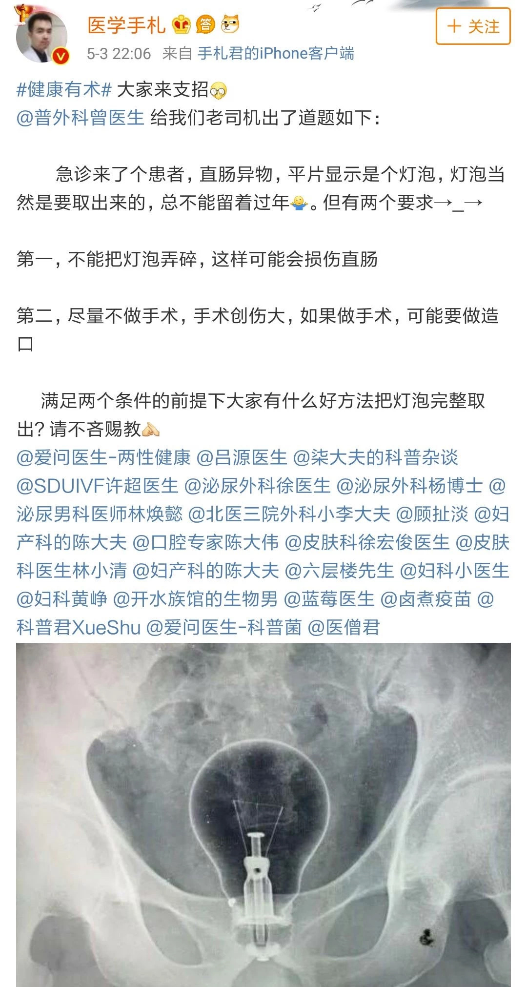 巴西男囚在屁股里藏8部手机4个插头，他这是把菊花当黑洞使？